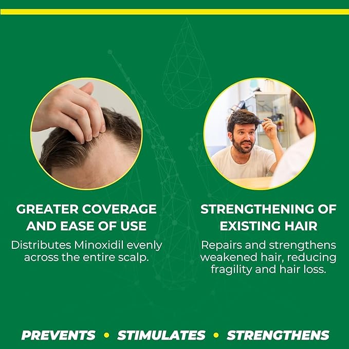 Hair Regrowth Super Kit Plus - 4-Piece Set with Minoxidil 2% & 5%