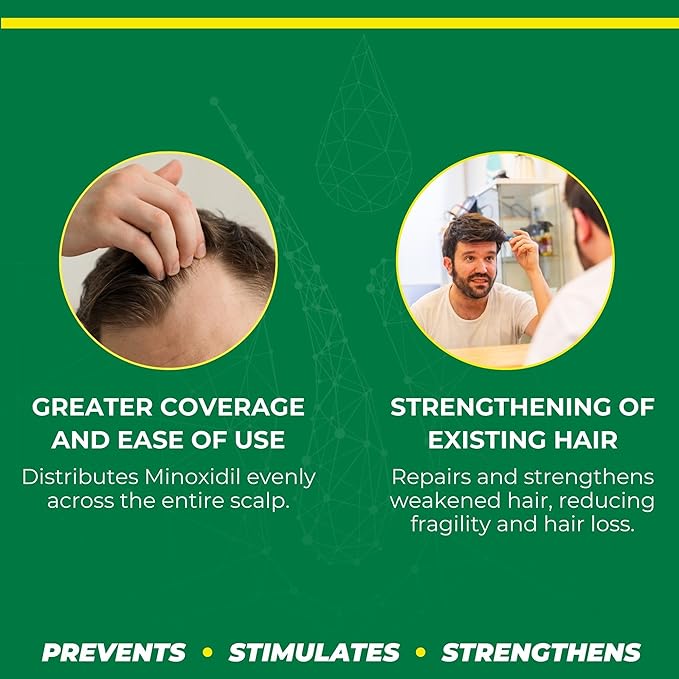 Minoxidil 2% Hair Regrowth Set - Complete 3-Step